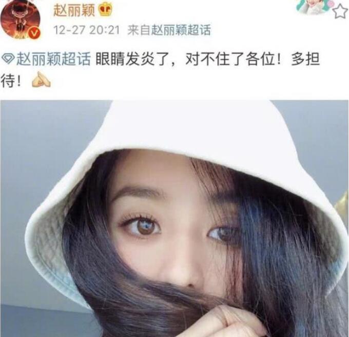 赵丽颖眼睛发炎 和粉丝说抱歉赵丽颖眼睛怎么会发炎