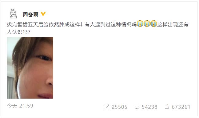 周冬雨拔完智齿脸肿 网友调侃：大脸特效！