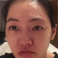 小S晒素颜照称：失眠是最可怕的事