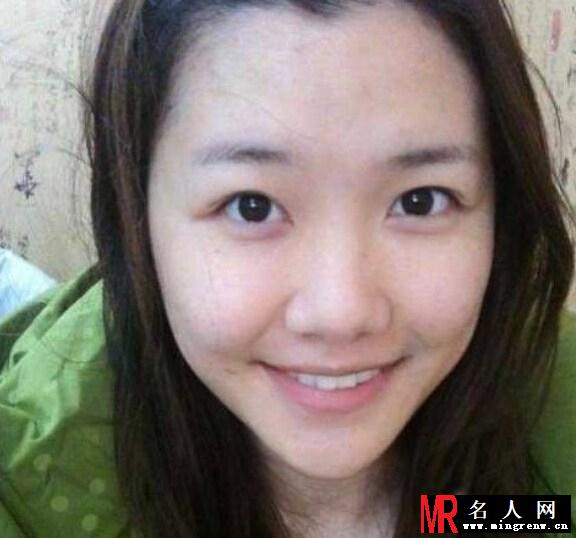 刘语熙被曝整容 昔日银盆脸曝光(1)