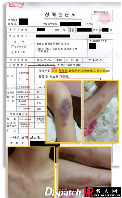 韩国演艺圈多事之秋 逃税车祸性丑闻(1)
