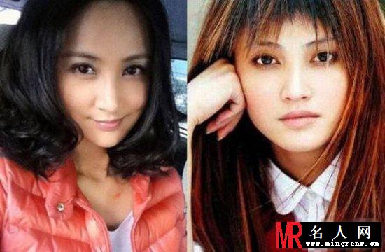 唐嫣刘诗诗 明星整容前后对比照大曝光(1)