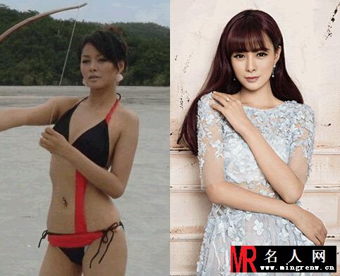 沈梦辰整容前后照片对比相差较大(1)