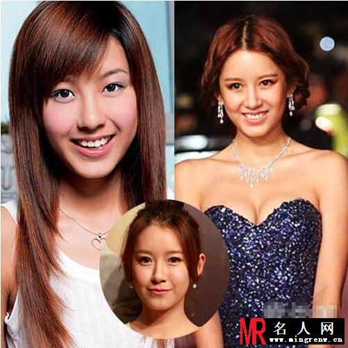 小三张子萱承认整容 整容前后对比照曝光(1)
