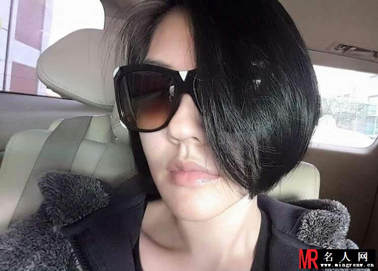 小s再陷家暴传言 左眼冒出大块淤青(1)