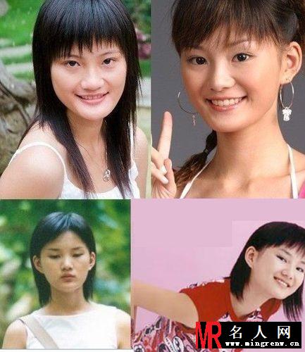 唐嫣刘诗诗 明星整容前后对比照大曝光(1)