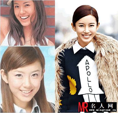 小三张子萱承认整容 整容前后对比照曝光(1)