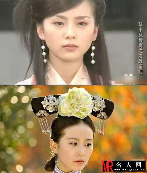 唐嫣刘诗诗 明星整容前后对比照大曝光(1)