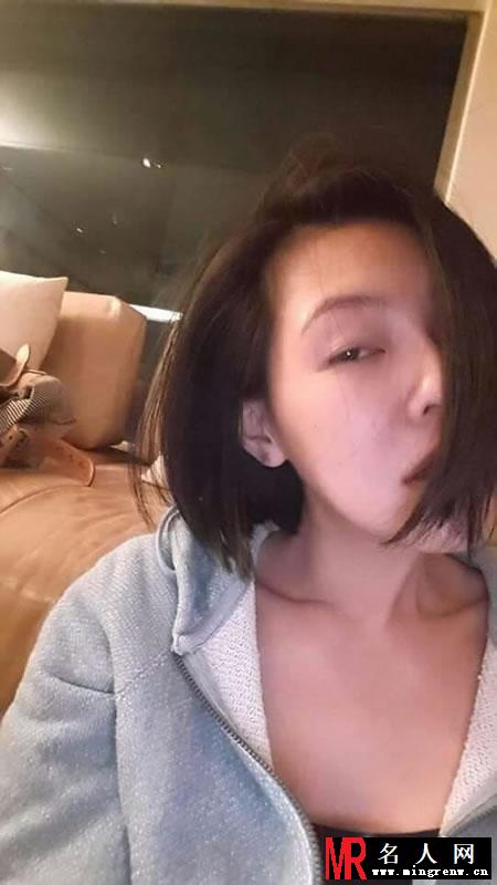 小S微博自拍疑似家暴 左脸伤痕曝光(1)