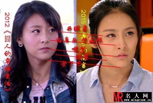 假脸姐妹团再添一枚 贾青整容前后照曝光(1)
