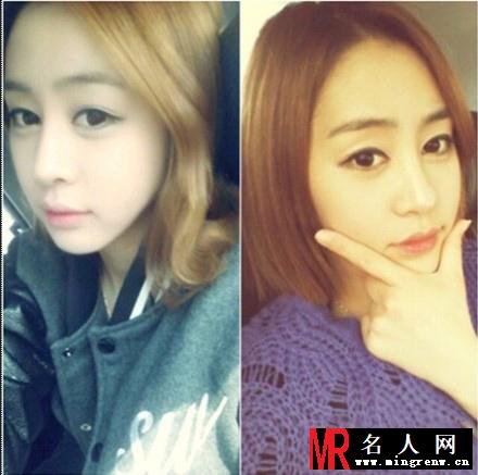 LET美人许艺恩整容对比照 地包天变锥子脸(1)