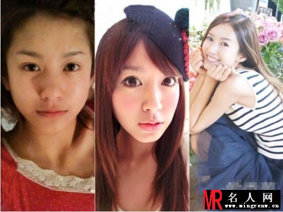 小三张子萱承认整容 整容前后对比照曝光(1)