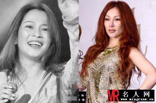 明星整容成潮流 这些女星披假皮混迹娱乐圈(1)