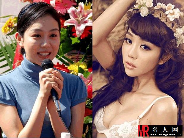 网传姜妍整容前后对比照：秒变大妈(1)