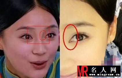 网传袁姗姗整容后变“六不像”说法(1)