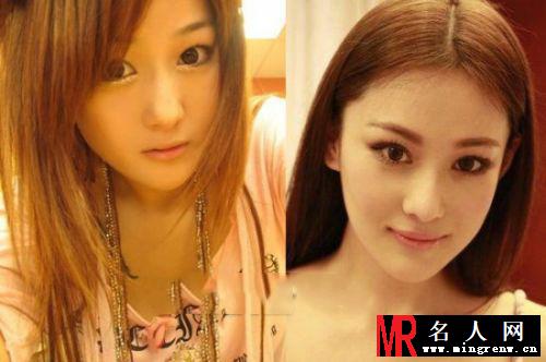 明星整容成潮流 这些女星披假皮混迹娱乐圈(1)