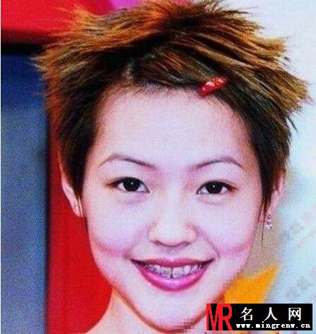 小S高圆圆林心如angelababy女星整容前龅牙丑照曝光(1)