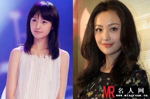 明星整容成潮流 这些女星披假皮混迹娱乐圈(1)