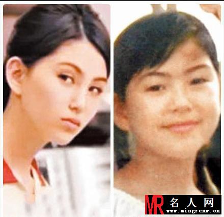 周杰伦新娘昆凌被曝整容前照片遭网友吐槽：惨不忍睹(1)