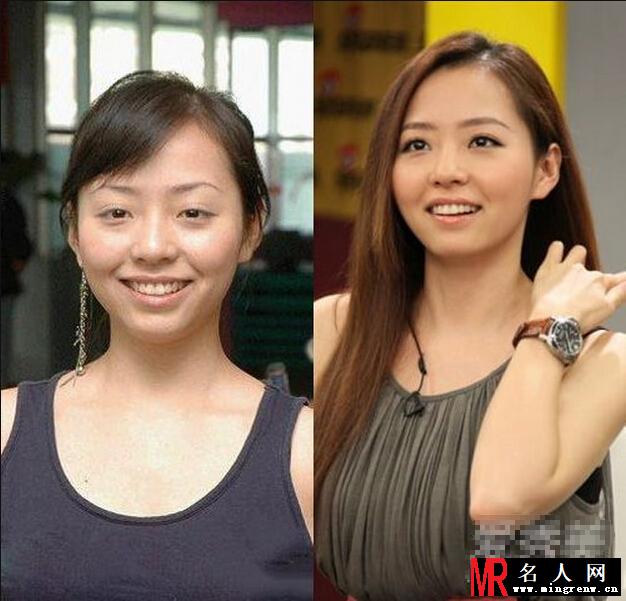 《我是歌手3》张靓颖被传整容 土妹与女神对比照曝光(1)