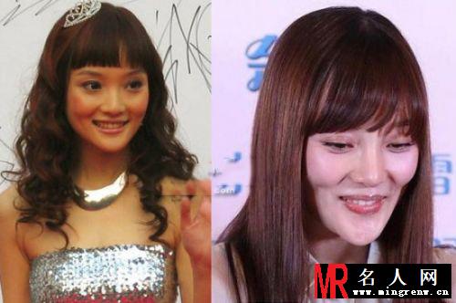 明星整容成潮流 这些女星披假皮混迹娱乐圈(1)